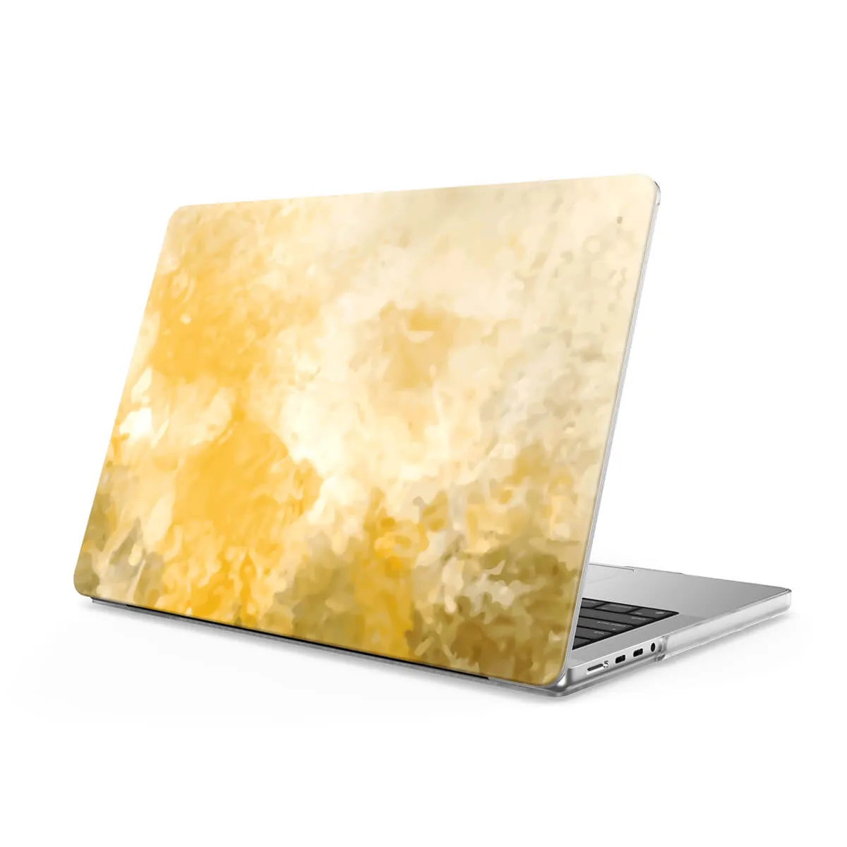 Autumn Forest | Macbook Anti-Fall Protective Case